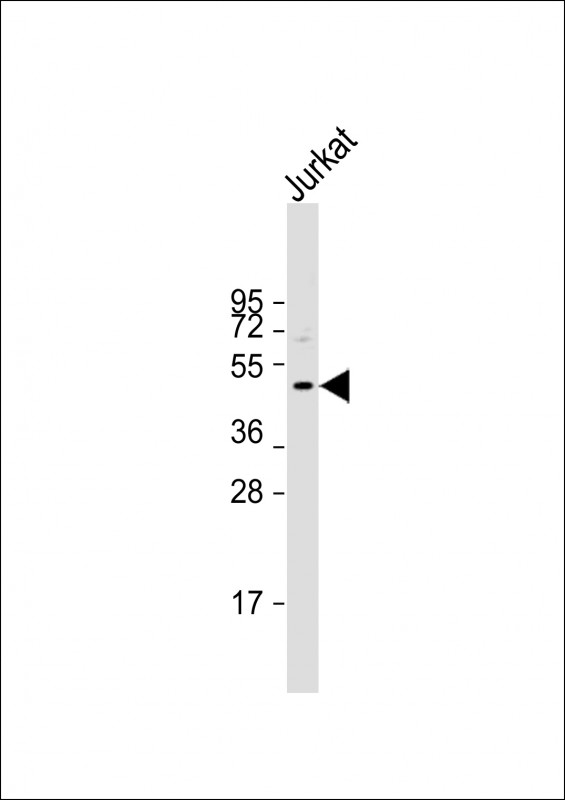 Anti-DDI2 Antibody (Center) at 1:500 dilution + Jurkat whole cell lysate Lysates/proteins at 20 µg per lane. Secondary Goat Anti-Rabbit IgG, (H+L), Peroxidase conjugated at 1/10000 dilution. Predicted band size : 45 kDa Blocking/Dilution buffer: 5% NFDM/TBST.