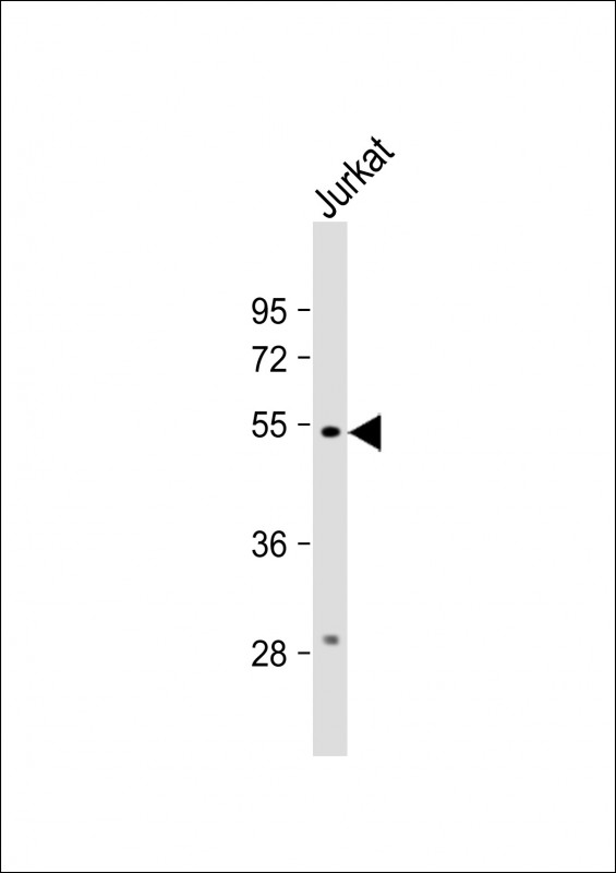 Anti-C13orf18 Antibody (Center) at 1:1000 dilution + Jurkat whole cell lysate Lysates/proteins at 20 µg per lane. Secondary Goat Anti-Rabbit IgG, (H+L), Peroxidase conjugated at 1/10000 dilution. Predicted band size : 73 kDa Blocking/Dilution buffer: 5% NFDM/TBST.