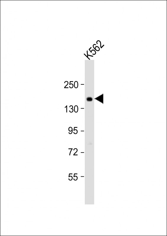 Anti-ADCY10 Antibody (Center) at 1:1000 dilution + K562 whole cell lysate Lysates/proteins at 20 µg per lane. Secondary Goat Anti-Rabbit IgG, (H+L), Peroxidase conjugated at 1/10000 dilution. Predicted band size : 187 kDa Blocking/Dilution buffer: 5% NFDM/TBST.
