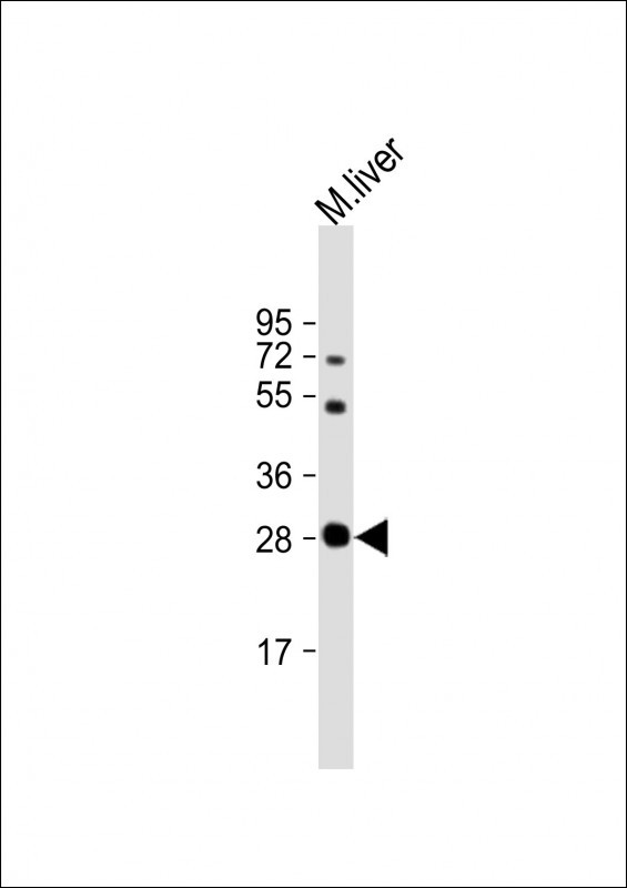 Anti-Sirt3 Antibody (C-term) at 1:64000 dilution + mouse liver lysate Lysates/proteins at 20 µg per lane. Secondary Goat Anti-Rabbit IgG, (H+L), Peroxidase conjugated at 1/10000 dilution. Predicted band size : 37 kDa Blocking/Dilution buffer: 5% NFDM/TBST.