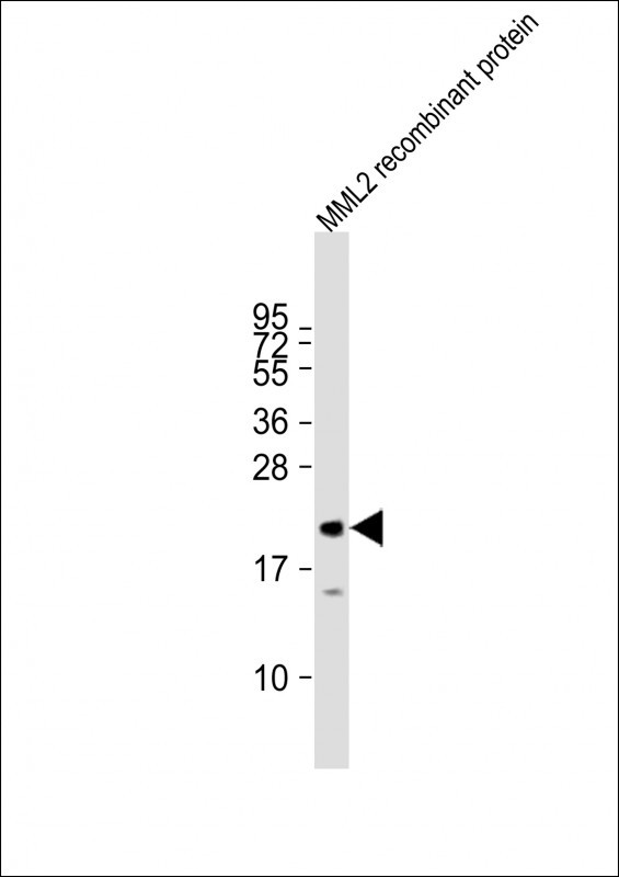 Anti-MLL2 Antibody (T4720) at 1:27000 dilution + HMML2 recombinant protein Lysates/proteins at 20 µg per lane. Secondary Goat Anti-Rabbit IgG, (H+L), Peroxidase conjugated at 1/10000 dilution. Predicted band size : 12 kDa Blocking/Dilution buffer: 5% NFDM/TBST.