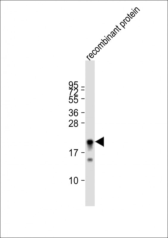 Anti-MLL2 Antibody (T4720) at 1:80000 dilution + recombinant protein whole cell lysate Lysates/proteins at 20 µg per lane. Secondary Goat Anti-Rabbit IgG, (H+L), Peroxidase conjugated at 1/10000 dilution. Predicted band size : 593 kDa Blocking/Dilution buffer: 5% NFDM/TBST.
