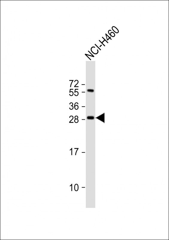 Anti-FGF18 Antibody (N-term) at 1:2000 dilution + NCI-H460 whole cell lysate Lysates/proteins at 20 µg per lane. Secondary Goat Anti-Rabbit IgG, (H+L), Peroxidase conjugated at 1/10000 dilution. Predicted band size : 24 kDa Blocking/Dilution buffer: 5% NFDM/TBST.