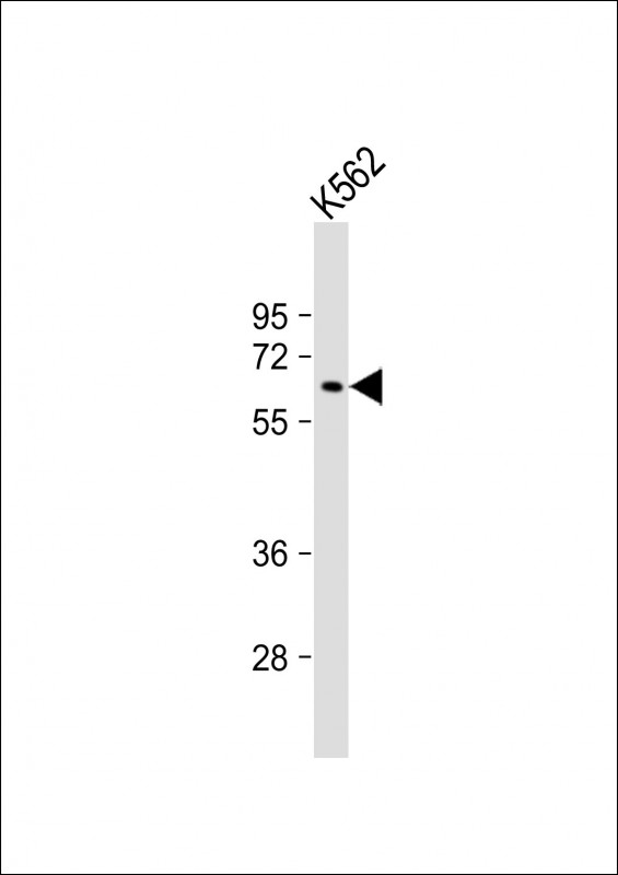 Anti-MTMR9 Antibody at 1:1000 dilution + K562 whole cell lysate Lysates/proteins at 20 µg per lane. Secondary Goat Anti-Rabbit IgG, (H+L), Peroxidase conjugated at 1/10000 dilution. Predicted band size : 63 kDa Blocking/Dilution buffer: 5% NFDM/TBST.