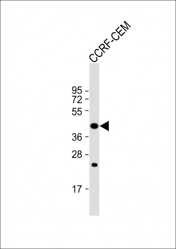 Anti-PTAR1 Antibody (Center) at 1:1000 dilution + CCRF-CEM whole cell lysate Lysates/proteins at 20 µg per lane. Secondary Goat Anti-Rabbit IgG, (H+L), Peroxidase conjugated at 1/10000 dilution. Predicted band size : 46 kDa Blocking/Dilution buffer: 5% NFDM/TBST.