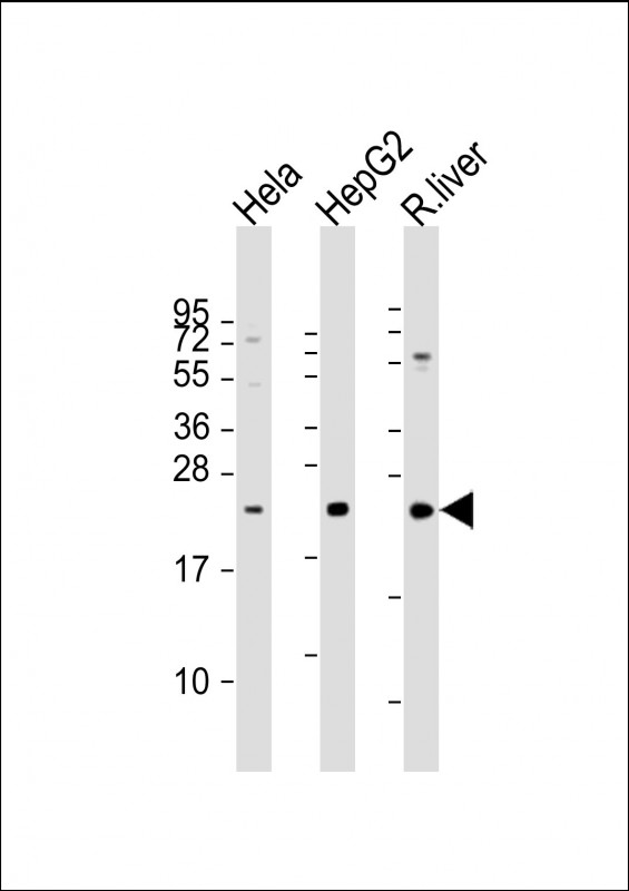 All lanes : Anti-TSPAN31 Antibody (Center) at 1:2000 dilution Lane 1: Hela whole cell lysate Lane 2: HepG2 whole cell lysate Lane 3: rat liver lysate Lysates/proteins at 20 µg per lane. Secondary Goat Anti-Rabbit IgG, (H+L), Peroxidase conjugated at 1/10000 dilution. Predicted band size : 23 kDa Blocking/Dilution buffer: 5% NFDM/TBST.