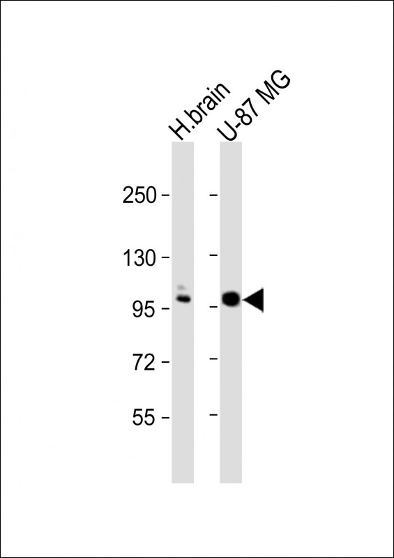 All lanes : Anti-ANO5 Antibody (C-term) at 1:1000 dilution Lane 1: human brain lysate Lane 2: U-87 MG whole cell lysate Lysates/proteins at 20 µg per lane. Secondary Goat Anti-Rabbit IgG, (H+L), Peroxidase conjugated at 1/10000 dilution. Predicted band size : 107 kDa Blocking/Dilution buffer: 5% NFDM/TBST.