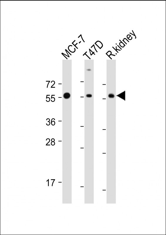 All lanes : Anti-CYP27B1 Antibody (C-term) at 1:2000 dilution Lane 1: MCF-7 whole cell lysate Lane 2: T47D whole cell lysate Lane 3: Rat kidney lysate Lysates/proteins at 20 µg per lane. Secondary Goat Anti-Rabbit IgG, (H+L), Peroxidase conjugated at 1/10000 dilution. Predicted band size : 57 kDa Blocking/Dilution buffer: 5% NFDM/TBST.