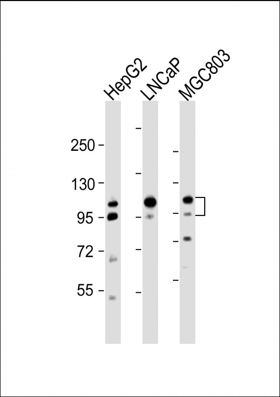 All lanes : Anti-ANO7 Antibody (N-term) at 1:2000 dilution Lane 1: HepG2 whole cell lysate Lane 2: LNCaP whole cell lysate Lane 3: MGC803 whole cell lysate Lysates/proteins at 20 µg per lane. Secondary Goat Anti-Rabbit IgG, (H+L), Peroxidase conjugated at 1/10000 dilution. Predicted band size : 106 kDa Blocking/Dilution buffer: 5% NFDM/TBST.