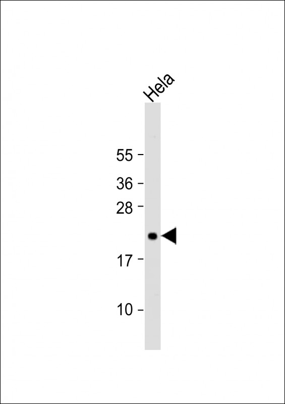 Anti-TIFA Antibody (N-term) at 1:2000 dilution + Hela whole cell lysate Lysates/proteins at 20 µg per lane. Secondary Goat Anti-Rabbit IgG, (H+L), Peroxidase conjugated at 1/10000 dilution. Predicted band size : 21 kDa Blocking/Dilution buffer: 5% NFDM/TBST.