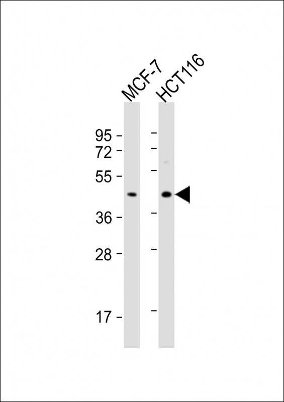 All lanes : Anti-PSG3 Antibody (N-term) at 1:1000 dilution Lane 1: MCF-7 whole cell lysate Lane 2: HCT116 whole cell lysate Lysates/proteins at 20 µg per lane. Secondary Goat Anti-Rabbit IgG, (H+L), Peroxidase conjugated at 1/10000 dilution. Predicted band size : 48 kDa Blocking/Dilution buffer: 5% NFDM/TBST.