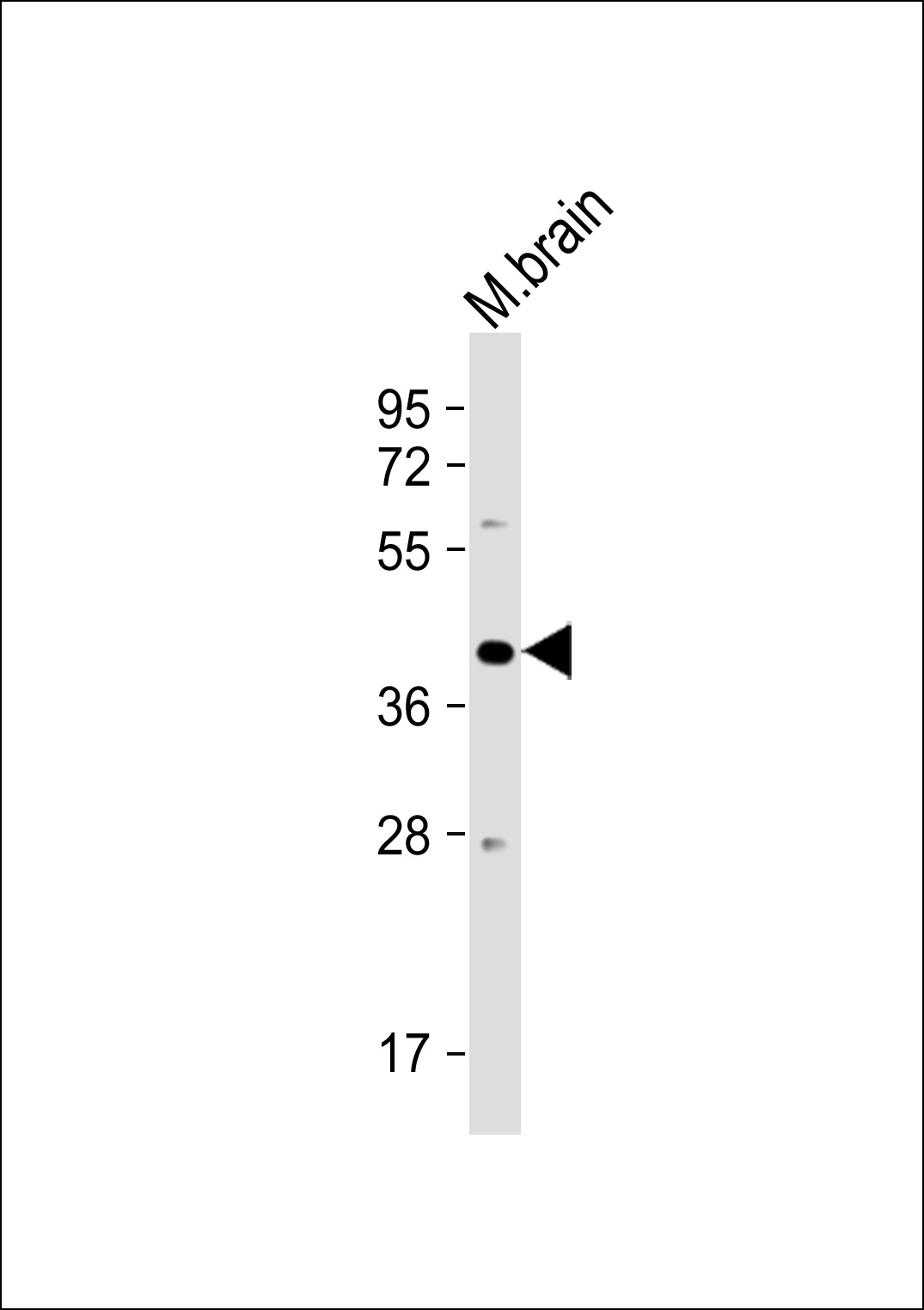 PSG3 Antibody (N-term) (Cat. #AP9558c) western blot analysis in MCF-7 cell line and mouse liver,brain tissue lysates (35ug/lane).This demonstrates the PSG3 antibody detected the PSG3 protein (arrow).
