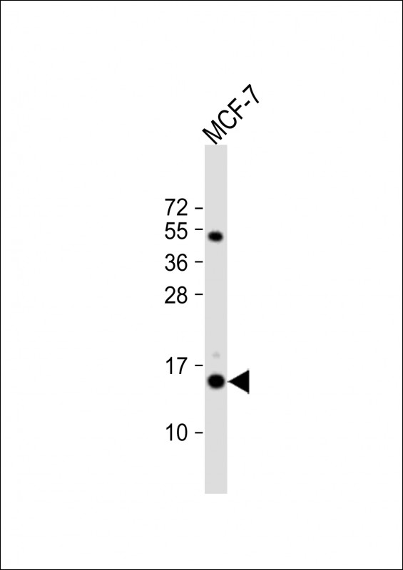 Anti-RPS24 Antibody (Center) at 1:1000 dilution + MCF-7 whole cell lysate Lysates/proteins at 20 µg per lane. Secondary Goat Anti-Rabbit IgG, (H+L), Peroxidase conjugated at 1/10000 dilution. Predicted band size : 15 kDa Blocking/Dilution buffer: 5% NFDM/TBST.