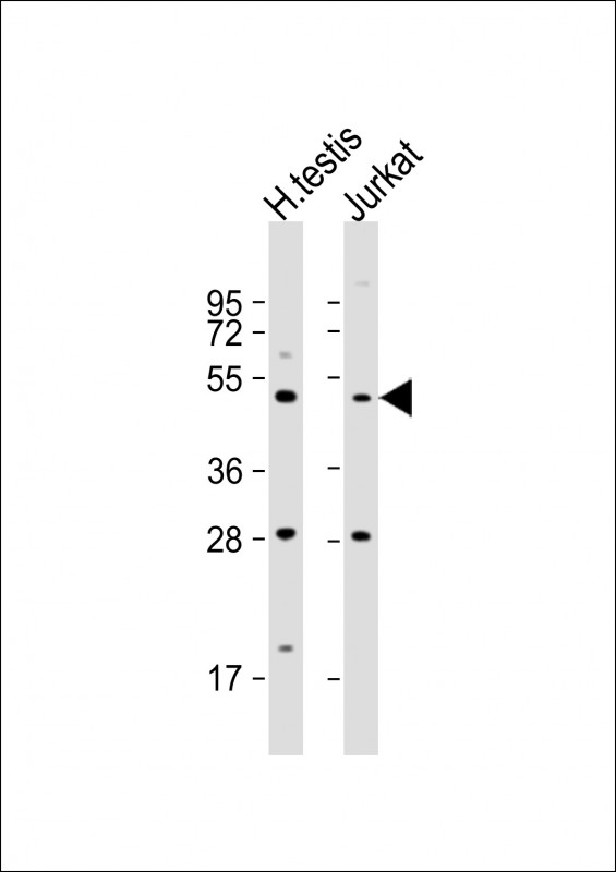 All lanes : Anti-OXCT2 Antibody (Center) at 1:1000 dilution Lane 1: human testis lysate Lane 2: Jurkat whole cell lysate Lysates/proteins at 20 µg per lane. Secondary Goat Anti-Rabbit IgG, (H+L), Peroxidase conjugated at 1/10000 dilution. Predicted band size : 56 kDa Blocking/Dilution buffer: 5% NFDM/TBST.