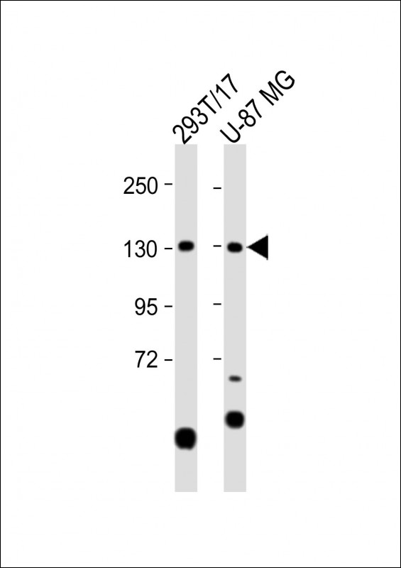 All lanes : Anti-SGSM1 Antibody (Center) at 1:1000 dilution Lane 1: 293T/17 whole cell lysate Lane 2: U-87 MG whole cell lysate Lysates/proteins at 20 µg per lane. Secondary Goat Anti-Rabbit IgG, (H+L), Peroxidase conjugated at 1/10000 dilution. Predicted band size : 130 kDa Blocking/Dilution buffer: 5% NFDM/TBST.