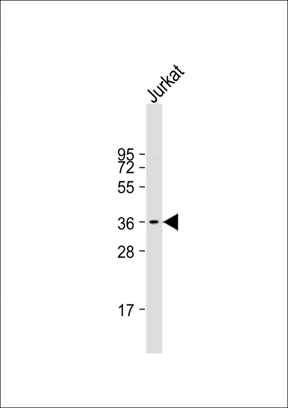 Anti-RFPL3 Antibody (N-term) at 1:1000 dilution + Jurkat whole cell lysate Lysates/proteins at 20 µg per lane. Secondary Goat Anti-Rabbit IgG, (H+L), Peroxidase conjugated at 1/10000 dilution. Predicted band size : 35 kDa Blocking/Dilution buffer: 5% NFDM/TBST.