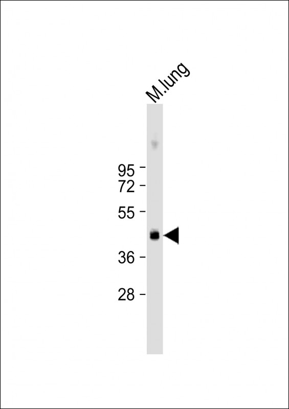 Anti-Mouse Plau Antibody (C-term) at 1:1000 dilution + mouse lung lysate Lysates/proteins at 20 µg per lane. Secondary Goat Anti-Rabbit IgG, (H+L), Peroxidase conjugated at 1/10000 dilution. Predicted band size : 48 kDa Blocking/Dilution buffer: 5% NFDM/TBST.