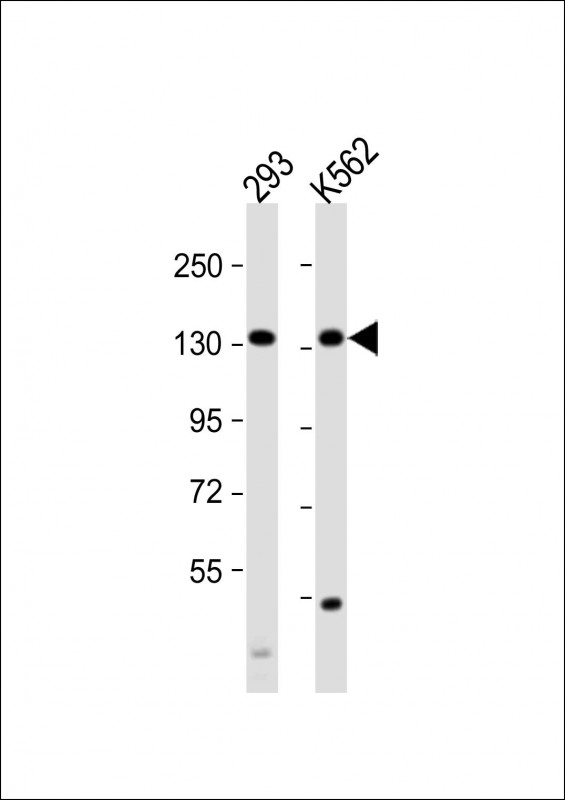 All lanes : Anti-MCM9 Antibody (C-term) at 1:1000 dilution Lane 1: 293 whole cell lysate Lane 2: K562 whole cell lysate Lysates/proteins at 20 µg per lane. Secondary Goat Anti-Rabbit IgG, (H+L), Peroxidase conjugated at 1/10000 dilution. Predicted band size : 127 kDa Blocking/Dilution buffer: 5% NFDM/TBST.