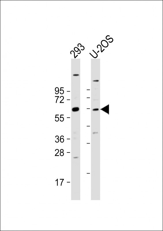 All lanes : Anti-TRIM6 Antibody (N-term) at 1:2000 dilution Lane 1: 293 whole cell lysate Lane 2: U-2OS whole cell lysate Lysates/proteins at 20 µg per lane. Secondary Goat Anti-Rabbit IgG, (H+L), Peroxidase conjugated at 1/10000 dilution. Predicted band size : 56 kDa Blocking/Dilution buffer: 5% NFDM/TBST.