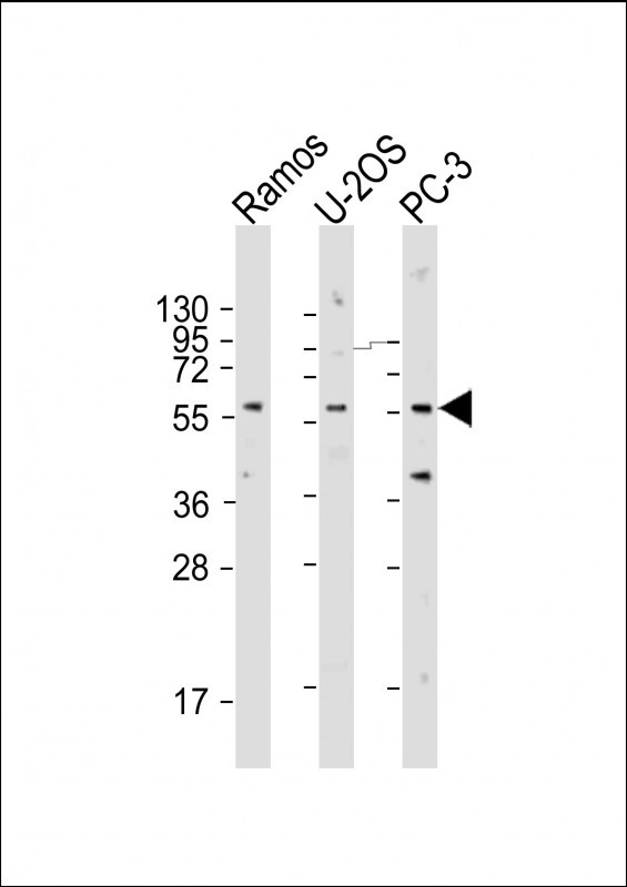 All lanes : Anti-TRIM6 Antibody (N-term) at 1:2000 dilution Lane 1: Ramos whole cell lysate Lane 2: U-2OS whole cell lysate Lane 3: PC-3 whole cell lysate Lysates/proteins at 20 µg per lane. Secondary Goat Anti-Rabbit IgG, (H+L), Peroxidase conjugated at 1/10000 dilution. Predicted band size : 56 kDa Blocking/Dilution buffer: 5% NFDM/TBST.