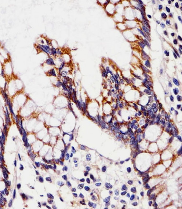 AP21028b staining CHST12 in Human small intestine tissue sections by Immunohistochemistry (IHC-P - paraformaldehyde-fixed, paraffin-embedded sections). Tissue was fixed with formaldehyde and blocked with 3% BSA for 0. 5 hour at room temperature; antigen retrieval was by heat mediation with a citrate buffer (pH6). Samples were incubated with primary antibody (1/25) for 1 hours at 37°C. A undiluted biotinylated goat polyvalent antibody was used as the secondary antibody.
