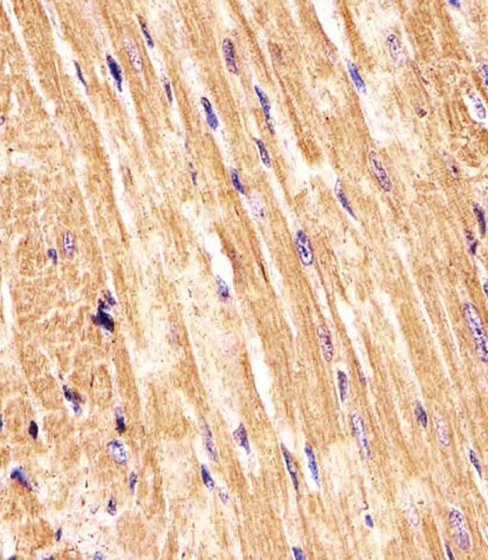 AP21203c staining (Mouse) Smad1 in Mouse heart tissue sections by Immunohistochemistry (IHC-P - paraformaldehyde-fixed, paraffin-embedded sections). Tissue was fixed with formaldehyde and blocked with 3% BSA for 0. 5 hour at room temperature; antigen retrieval was by heat mediation with a citrate buffer (pH6). Samples were incubated with primary antibody (1/25) for 1 hours at 37°C. A undiluted biotinylated goat polyvalent antibody was used as the secondary antibody.