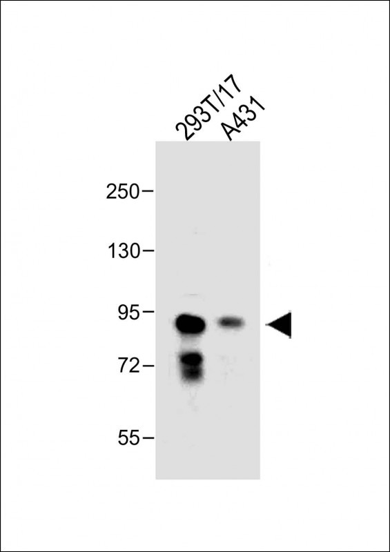 All lanes : Anti-DEPDC1 Antibody (N-term) at 1:1000 dilution Lane 1: 293T/17 whole cell lysate Lane 2: A431 whole cell lysate Lysates/proteins at 30 µg per lane. Secondary Goat Anti-Rabbit IgG, (H+L), Peroxidase conjugated at 1/10000 dilution. Predicted band size : 93kDa Blocking/Dilution buffer: 5% NFDM/TBST.