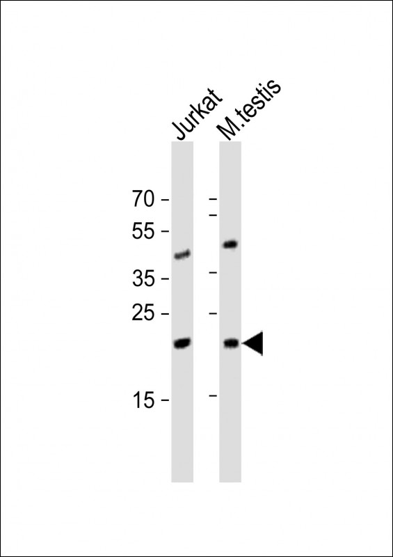 All lanes : Anti-ORMDL3 Antibody (Center) at 1:1000 dilution Lane 1: Jurkat whole cell lysate Lane 2: mouse testis lysate Lysates/proteins at 20 µg per lane. Secondary Goat Anti-Rabbit IgG, (H+L), Peroxidase conjugated at 1/10000 dilution. Predicted band size : 17 kDa Blocking/Dilution buffer: 5% NFDM/TBST.
