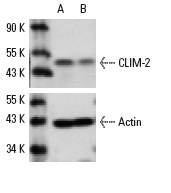 CLIM-2 siRNA (m): sc-35073. Western blot analysis of CLIM-2 expression in non-transfected control (A) and CLIM-2 transfected (B) NIH/3T3 cells. Blot probed with CLIM-2 (N-18): sc-11198. Actin (I-19): sc-1616 used as specificity and loading control.