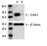 CLIM-2 siRNA (h): sc-35072. Western blot analysis of CLIM-2 expression in non-transfected control (A) and CLIM-2 transfected (B) HeLa cells. Blot probed with CLIM-2 (N-18): sc-11198. β Tubulin (D-10): sc-5274 used as specificity and loading control.