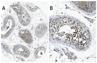 CREM (X-12): sc-440. Immunoperoxidase staining of formalin fixed, paraffin-embedded human testis tissue showing nuclear staining of cells in ductus seminiferus at low (A) and high (B) magnification. Kindly provided by The Swedish Human Protein Atlas (HPA) program.