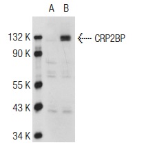 CRP2BP (2221C4a): sc-81072. Western blot analysis of CRP2BP expression in non-transfected: sc-117752 (A) and human CRP2BP transfected: sc-172463 (B) 293T whole cell lysates.