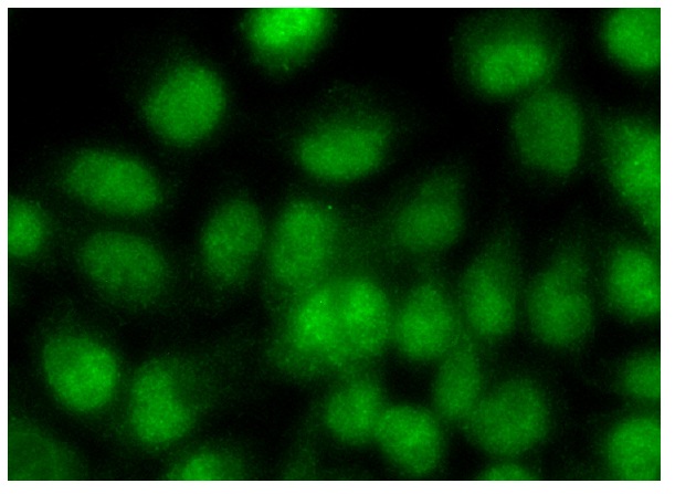 DDB1 (H-300): sc-25367. Immunofluorescence staining of formalin-fixed HeLa cells showing nuclear localization. Kindly provided by Yang Xiang, Ph.D., Division of Newborn Medicine, Boston Childrens Hospital, Cell Biology Department, Harvard Medical School.