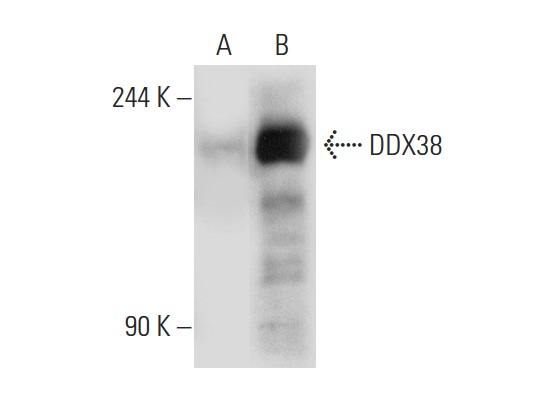 DDX38 (50): sc-135880. Western blot analysis of DDX38 expression in non-transfected: sc-117752 (A) and human DDX38 transfected: sc-174917 (B) 293T whole cell lysates.