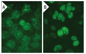 DDX38 (50): sc-135880. Immunofluorescence staining of methanol-fixed untransfected (A) and human DDX38 transfected HEK 293 cells (B).