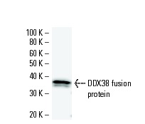 ZnT-9 (919C1a): sc-81118 Western Blot analysis of human recombinant ZnT-9 fusion protein.