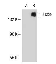 DDX38 (2271C1a): sc-81081. Western blot analysis of DDX38 expression in non-transfected: sc-117752 (A) and mouse DDX38 transfected: sc-119719 (B) 293T whole cell lysates.