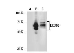 DDX56 (5A7): sc-101018. Western blot analysis of DDX56 expression in non-transfected: sc-110760 (A) and human DDX56 transfected: sc-110647 (B) 293 whole cell lysates.