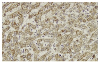 DDX56 (5A7): sc-101018. Immunoperoxidase staining of formalin-fixed, paraffin-embedded human liver tissue showing cytoplasmic localization.