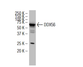 DDX56 (5A7): sc-101018. Western blot analysis of DDX56 expression in HeLa whole cell lysate.
