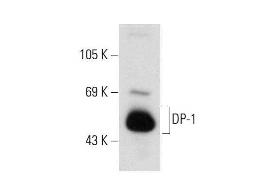 DP-1 (K-20): sc-610. Western blot analysis of DP-1 expression in Daudi whole cell lysate.