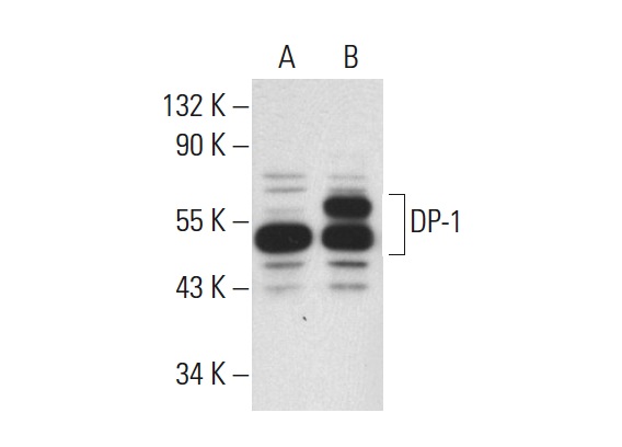 DP-1 (K-20): sc-610. Western blot analysis of DP-1 expression in non-transfected: sc-117752 (A) and human DP-1 transfected: sc-159192 (B) 293T whole cell lysates.