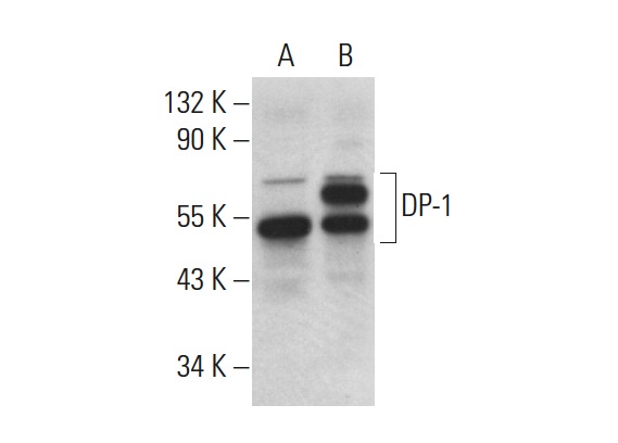 DP-1 (TFD-11): sc-56657. Western blot analysis of DP-1 expression in non-transfected: sc-117752 (A) and human DP-1 transfected: sc-159192 (B) 293T whole cell lysates.