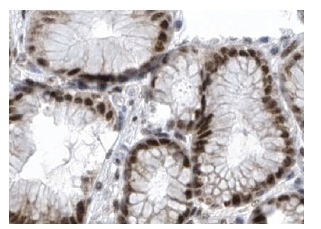DP-1 (TFD-11): sc-56657. Immunoperoxidase staining of formalin fixed, paraffin-embedded human stomach tissue showing nuclear staining of glandular cells at high magnification. Kindly provided by The Swedish Human Protein Atlas (HPA) program.