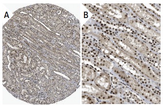 DP-2 (C-20): sc-829. Immunoperoxidase staining of formalin fixed, paraffin-embedded human kidney tissue showing nuclear and cytoplasmic staining of cells in glomeruli and tubules (low and high magnification). Kindly provided by The Swedish Human Protein Atlas (HPA) program.