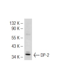 DP-2 (C-20): sc-829. Western blot analysis of DP-2 expression in H4 whole cell lysate.