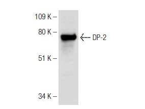 DP-2 (C-20): sc-829. Western blot analysis of DP-2 expression in A-431 whole cell lysate.
