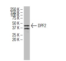 DPF2 (WW-2): sc-101106. Western blot analysis of DPF2 expression in LNCaP whole cell lysate.