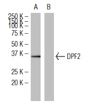 DPF2 (WW-2): sc-101106 Western blot analysis of DPF2 expression in human DPF2 transfected (A) and non-transfected (B) 293T whole cell lysates.