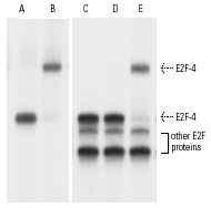 Gel supershift analysis of E2F proteins isolated by immunoprecipitation using either p107 (A,B) or Rb p110 (C-E) antibodies. E2F-4 released from p107/E2F complexes and incubated with <sup>32</sup>P-labeled E2F binding sites specific oligonucleotide was supershifted by E2F-4 (C-108) X: sc-512 X antibody (B) as compared to control IgG (A). Similarly, E2F-4 released from Rb p110/E2F complexes was supershifted by E2F-4 (C-108) X: sc-512 X (E), but not by E2F-1 (KH95) X: sc-251 X (D) as compared to control IgG (C). Kindly provided by Masa-aki Ikeda, Ph.D., D.D.S.